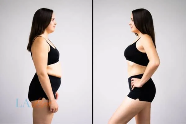 link between body image and mental health Eastbourne