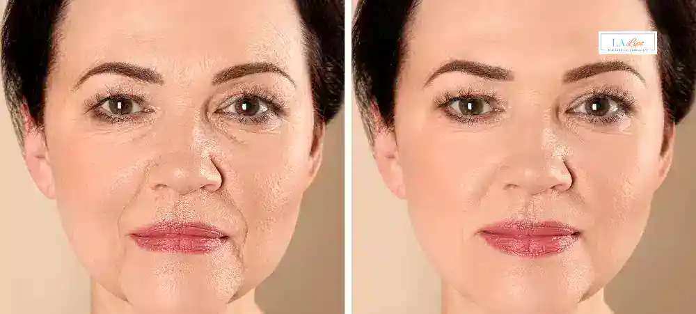 Why Aren’t My Skincare Products Making My Sagging Skin Look Firmer Eastbourne?